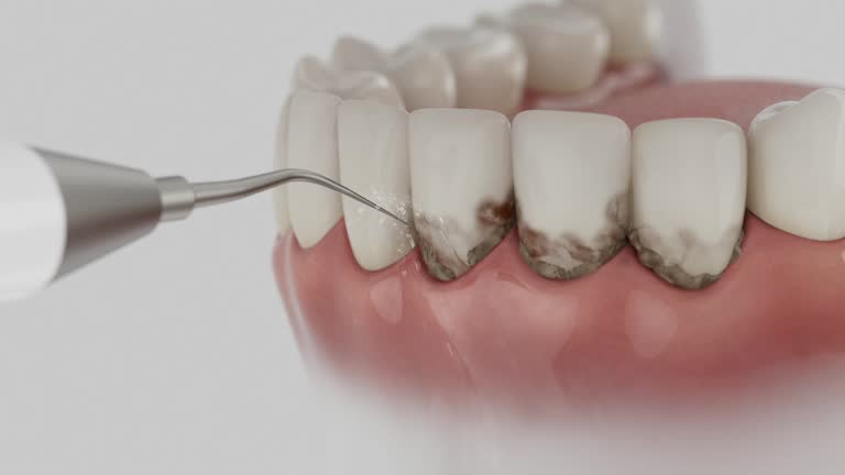 Reliable Tooth Extraction contractor in Pinehurst, TX by Smile Center Dentistry